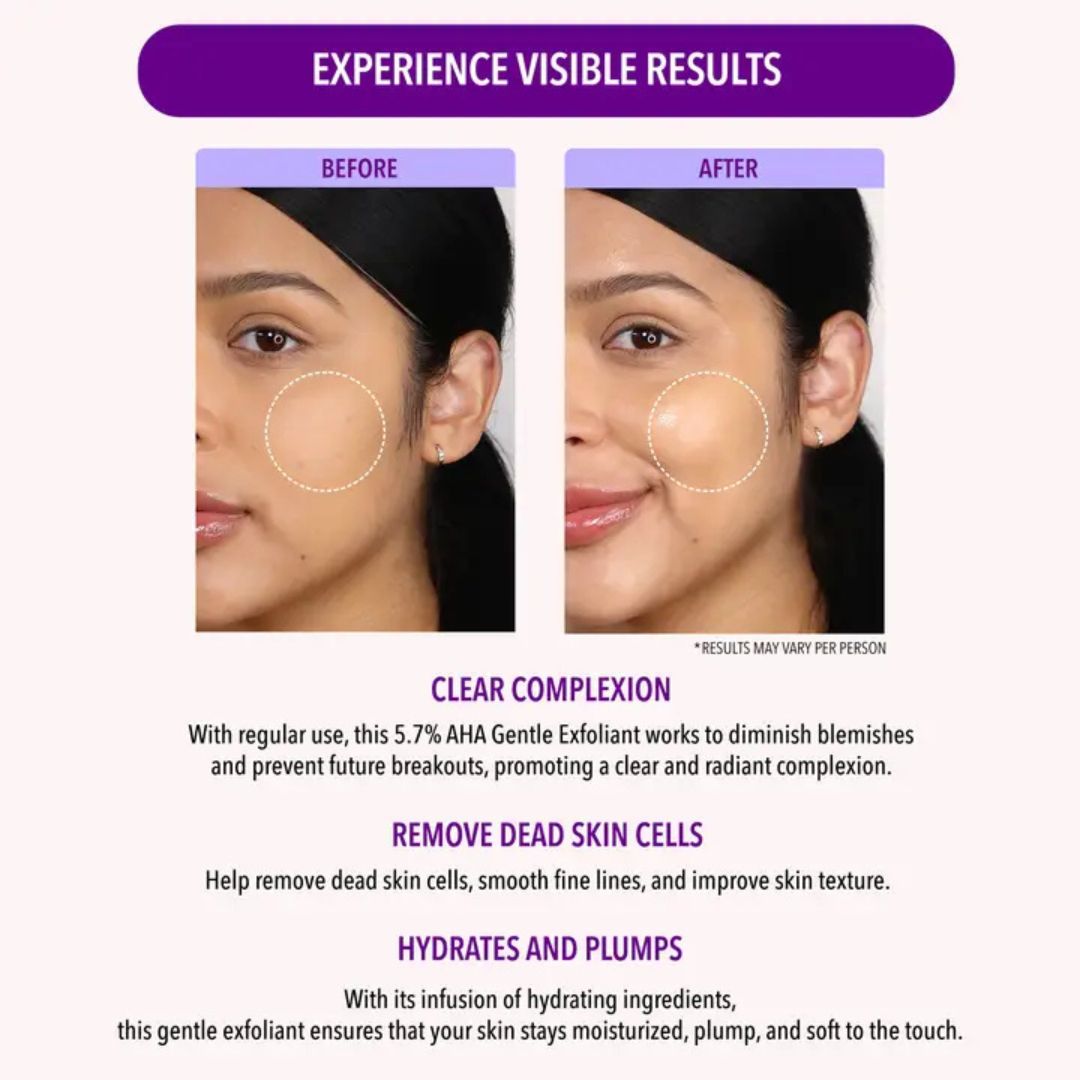 Moira, 5.7% Aha Gentle Exfoliant, Made in Korea