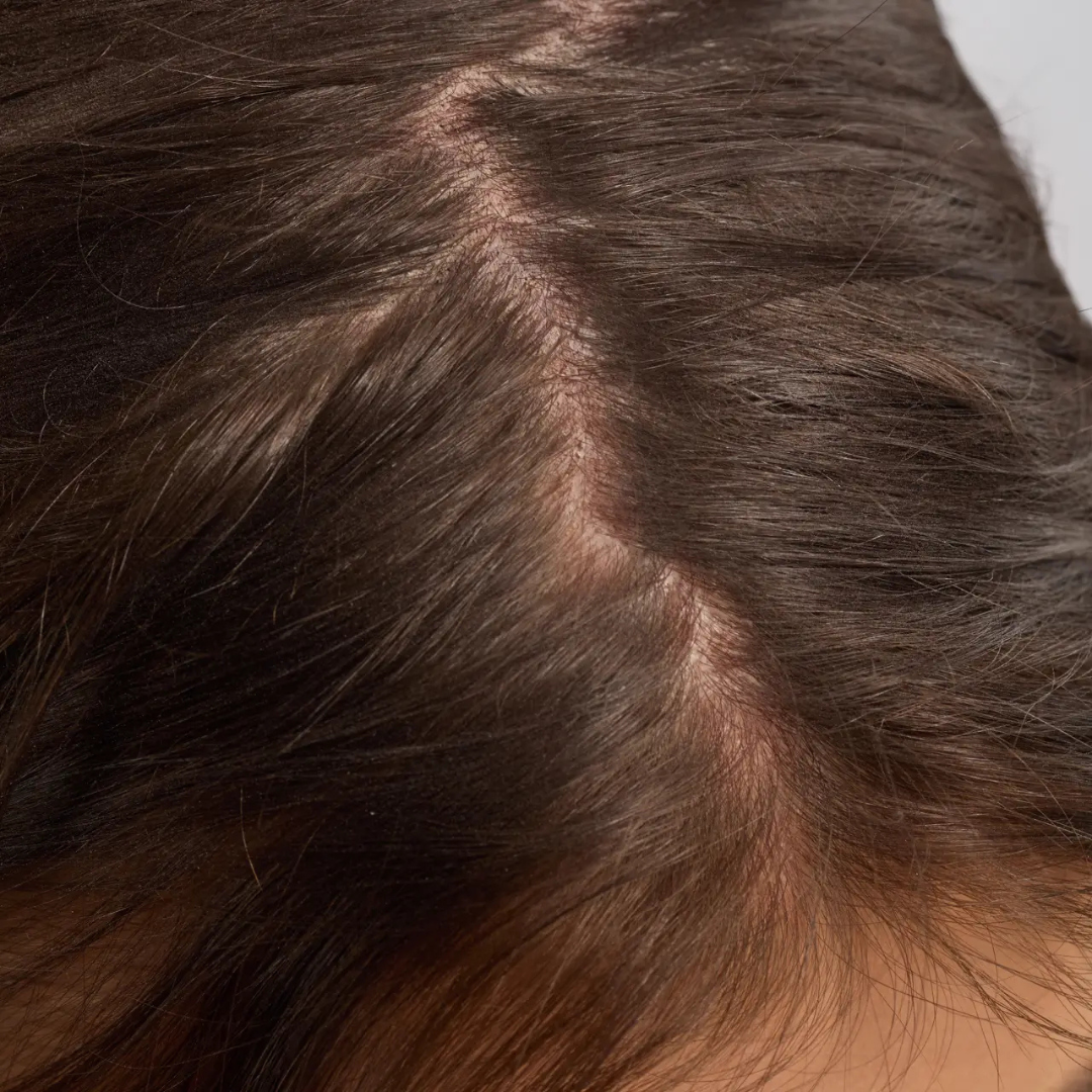 Kitsch, Strengthening Hair & Scalp Oil